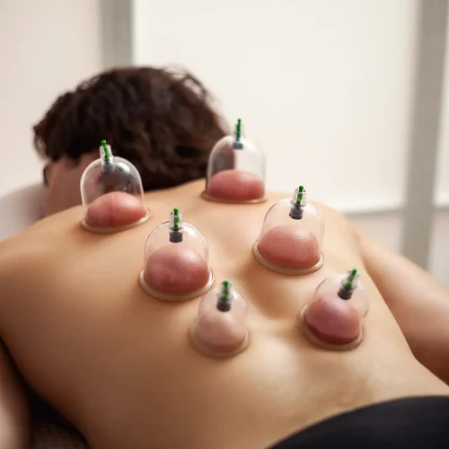 cupping-1 cupping-1