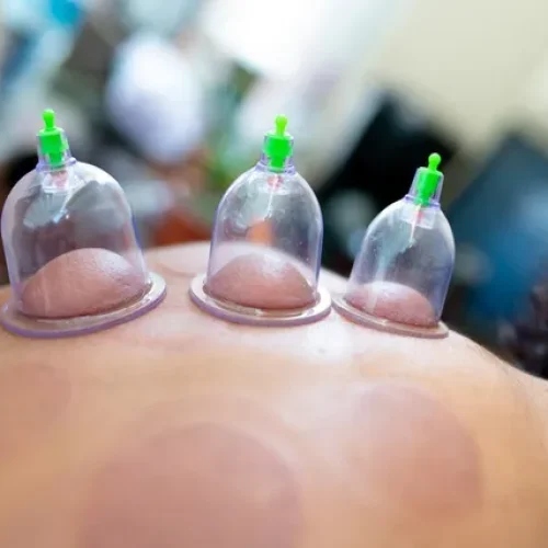 hindutan hijama therapy hindutan hijama therapy